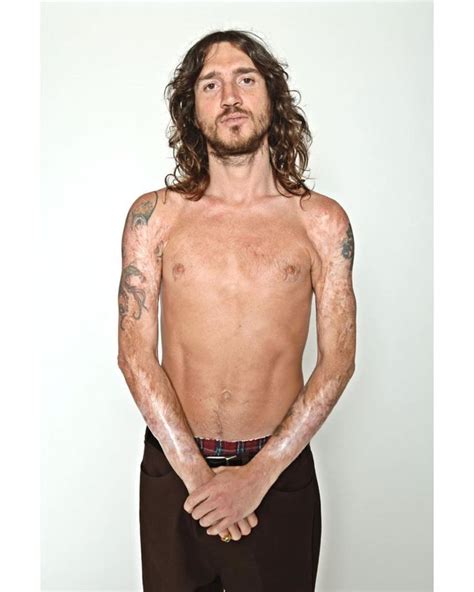 john frusciante arms|john frusciante burns on arms.